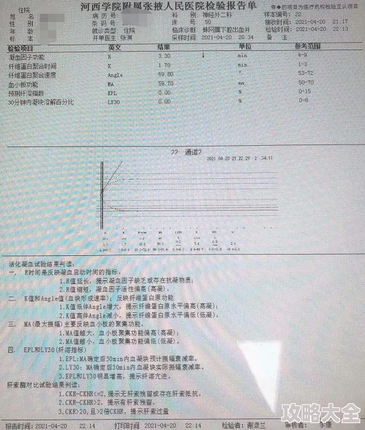 战争雷霆中WMA301与2S38性能对比：哪个更优秀